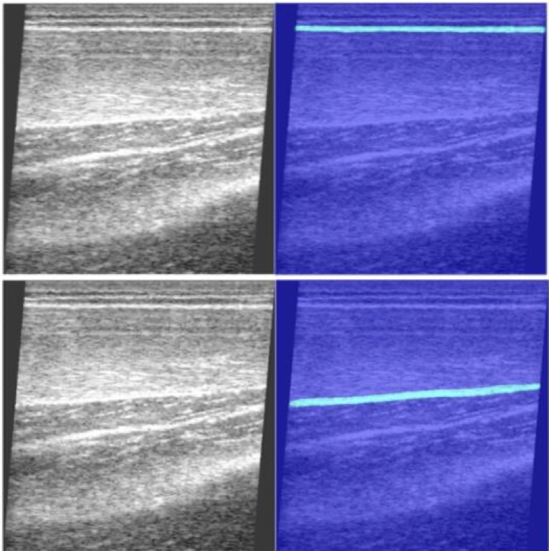 Raw thigh ultrasound images next to model predictions highlighting the top and bottom muscle borders in cyan